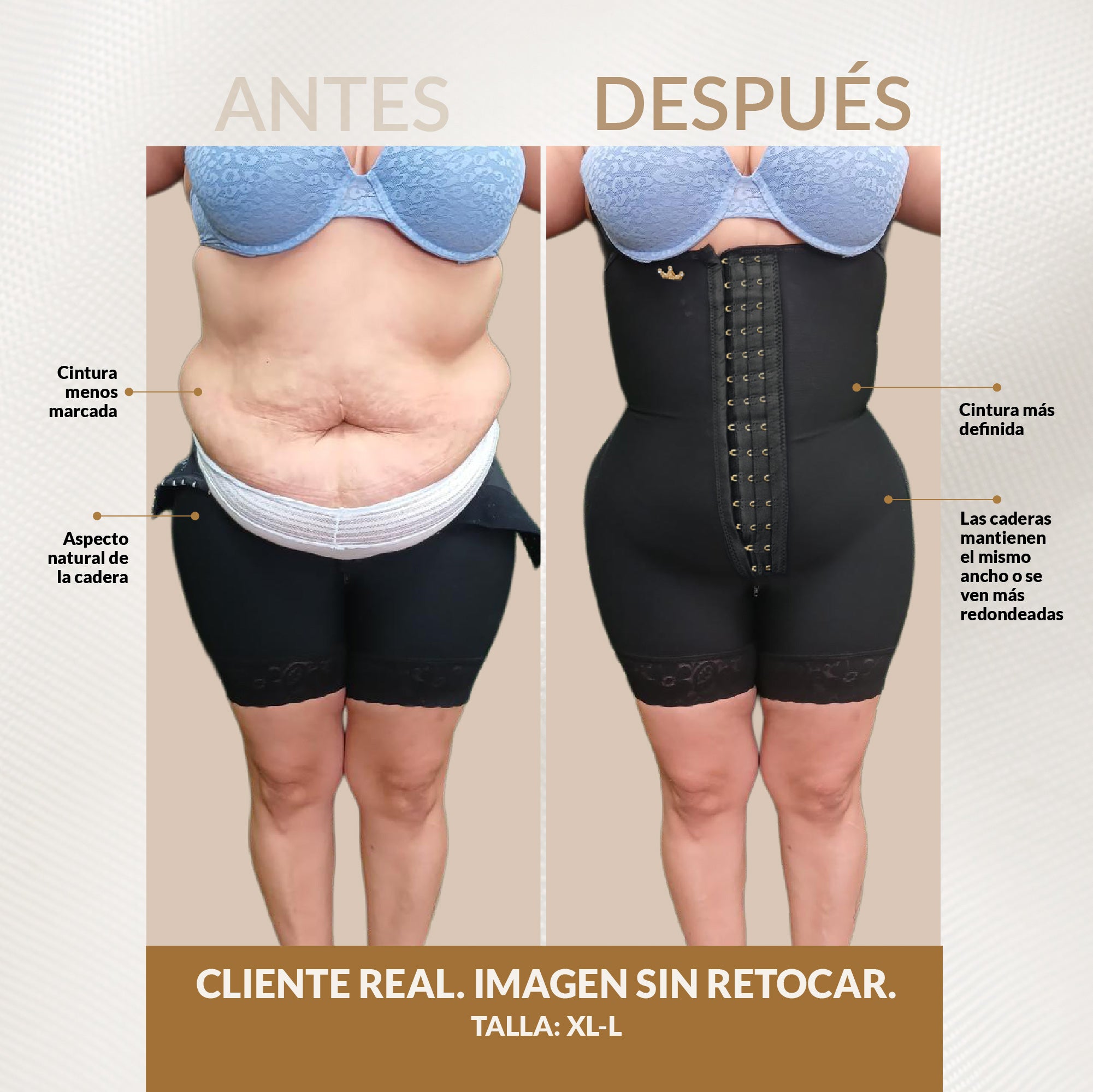 Fajas para caderas anchas - Luxury Queen (Ref. LuxBBL-213 | Ref. LuxBBL-013)